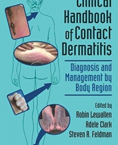 Clinical Handbook of Contact Dermatitis: Diagnosis and Management by Body Region