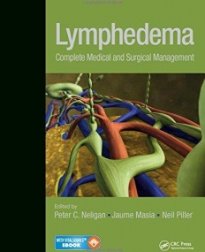 Lymphedema: Complete Medical and Surgical Management(B&Eb)