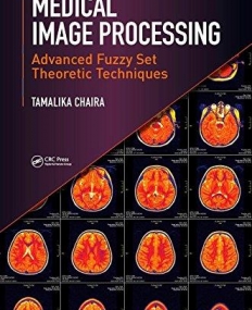 Medical Image Processing: Advanced Fuzzy Set Theoretic Techniques