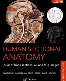 Human Sectional Anatomy: Atlas of Body Sections, CT and MRI Images, Fourth Edition(B&Eb)
