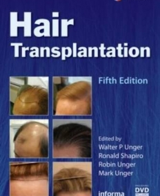 HAIR TRANSPLANTATION (WITH PROCEDURAL DVD), FIFTH EDITION