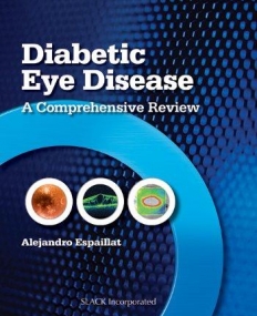 DIABETIC EYE DISEASE: A COMPREHENSIVE REVIEW