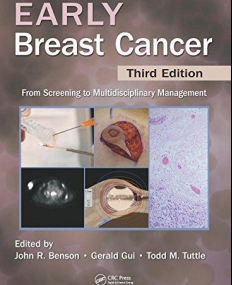 EARLY BREAST CANCER