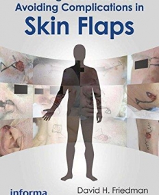 MAKING DECISIONS AND AVOIDING COMPLICATIONS IN SKIN FLAPS