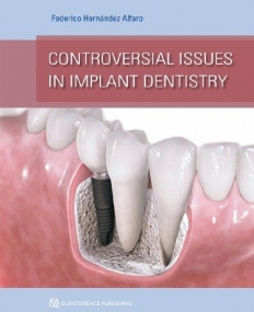 Controversial Issues in Implant Dentistry