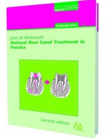 Rational Root Canal Treatment in Practice: Quintessentials of Dental  Pracitice Vol 2, 2nd edition