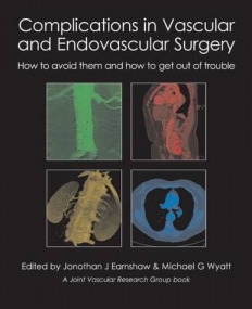 COMPLICATIONS IN VASCULAR AND ENDOVASCULAR SURGERY: HOW