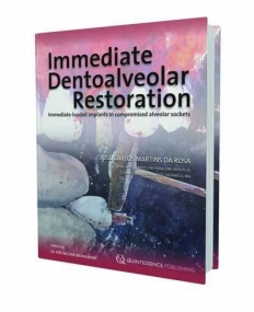 Immediate Dentoalveolar Restoration: Immediate-loaded Implants in compromised alveolar sockets