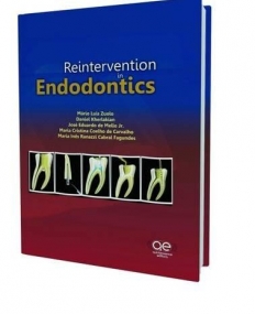 Reintervention in Endodontics