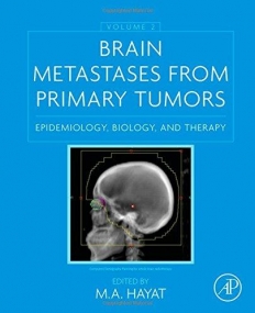 Brain Metastases from Primary Tumors, Volume 2