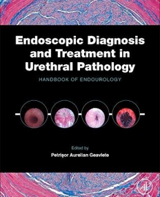 Endoscopic Diagnosis and Treatment in Urethral Pathology