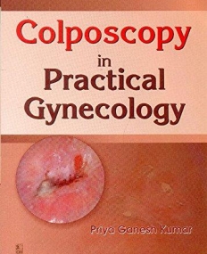 Colposcopy in Practical Gynecology