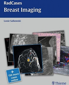 Th, radcases Breast Imaging