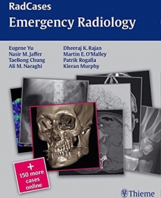 Th, Radcases Emergency Radiology