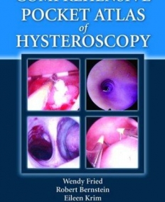 Comprehensive Pocket Atlas of Hysteroscopy