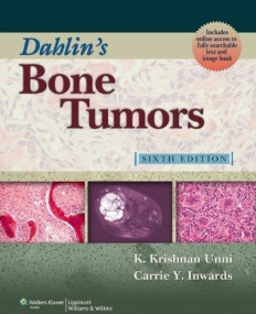 Dahlin's Bone Tumors : General Aspects and Data on 10,165 Cases