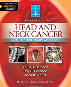 Head and Neck Cancer, None: A Multidisciplinary Approach