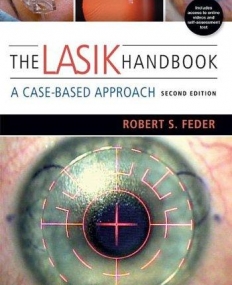 The LASIK Handbook: A Case-Based Approach