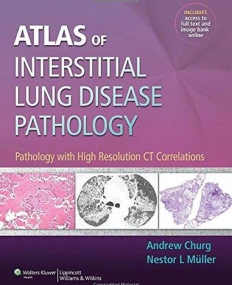 Atlas of Interstitial Lung Disease Pathology: Pathology with High Resolution CT Correlations