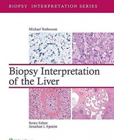 Biopsy Interpretation of the Liver (Biopsy Interpretation Series)