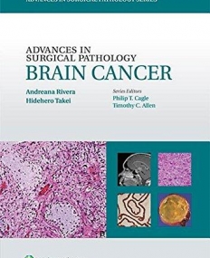 Advances in Surgical Pathology: Brain Cancer (Advances in Surgical Pathology)