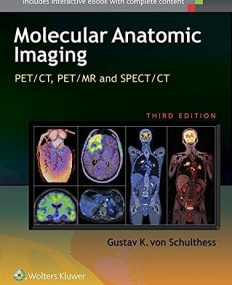 Molecular Anatomic Imaging