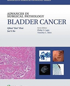 Bladder Cancer (Advances in Surgical Pathology)