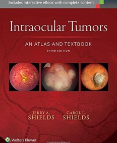 Intraocular Tumors: An Atlas and Textbook