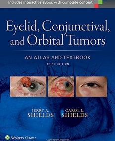 Eyelid, Conjunctival, and Orbital Tumors: An Atlas and Textbook