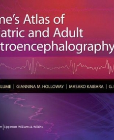 Blume's Atlas of Pediatric & Adult EEGs