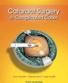 CATARACT SURGERY IN COMPLICATED CASES