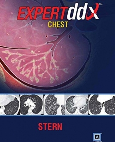 EXPERTddx: Chest: Published by Amirsysآ® (EXPERTddx (TM))آ 