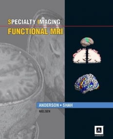 Specialty Imaging: Functional MRI: Published by Amirsys