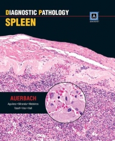 Diagnostic Pathology: Spleen: Published by Amirsys
