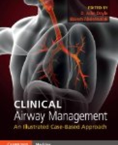 Clinical Airway Management: An Illustrated Case-Based Approach 