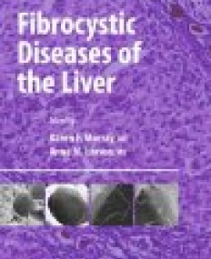 Fibrocystic Diseases of the Liver