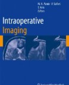 Intraoperative Imaging