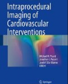 Intraprocedural Imaging of Cardiovascular Interventions