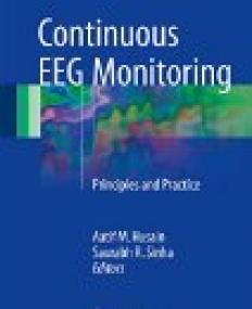 Continuous EEG Monitoring: Principles and Practice