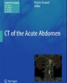 CT of the Acute Abdomen