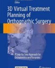 3D Virtual Treatment Planning of Orthognathic Surgery: A Step-by-Step Approach for Orthodontists and Surgeons