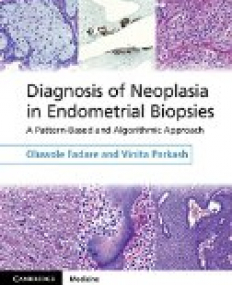 Diagnosis of Neoplasia in Endometrial Biopsies