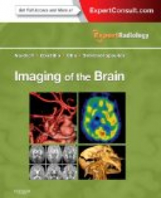 Imaging of the Brain, Expert Radiology Series