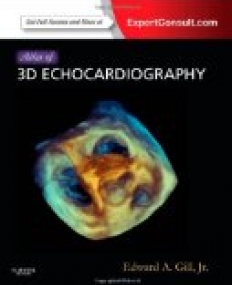 Atlas Of 3d Echocardiography