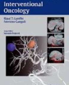 Interventional Oncology