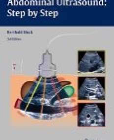 Abdominal Ultrasound: Step by Step