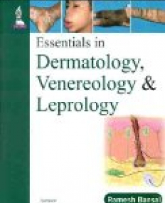 Essentials in Dermatology, Venereology and Leprology