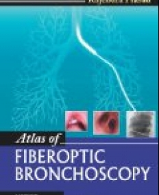 Atlas of Fiberoptic Bronchoscopy