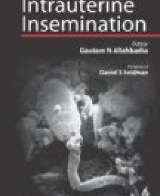 Intrauterine Insemination