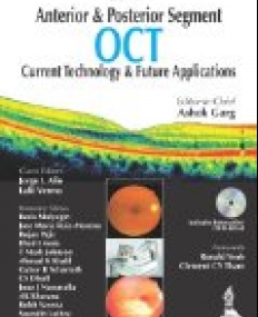 Anterior and Posterior Segment OCT: Current Technology and Future Applications